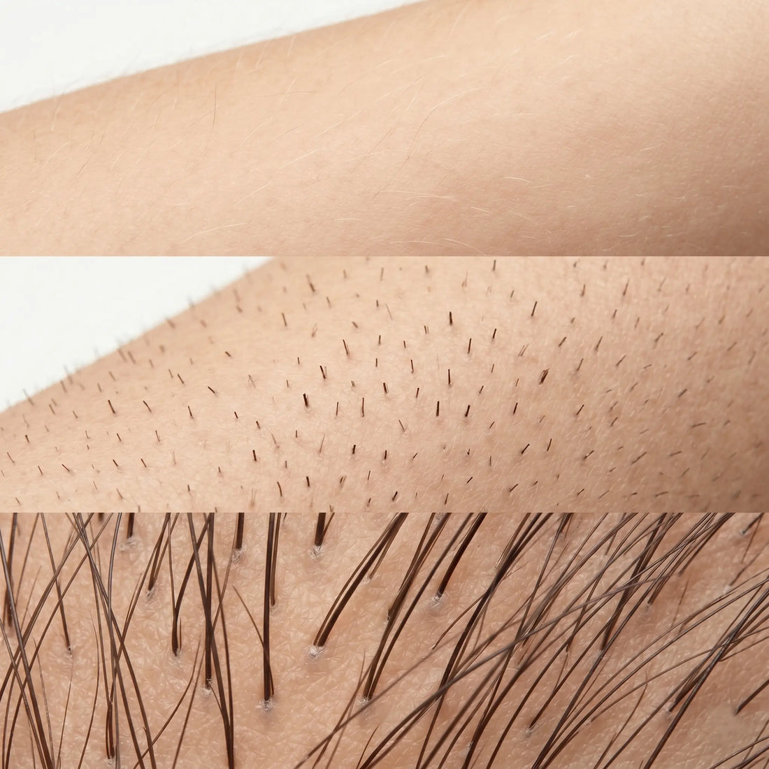 A three-panel comparison of hair textures on South Asian skin, showing fine vellus peach fuzz, sharp dark stubble, and thick coarse terminal hair.