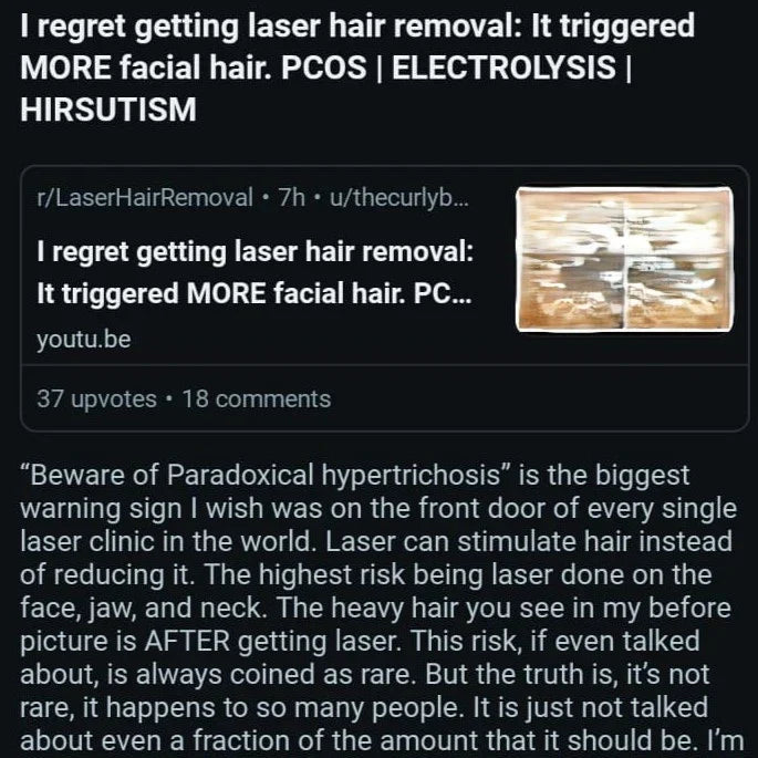 Screenshot of a Reddit discussion where a user explains how clinic laser made her facial hair worse, highlighting the reality of paradoxical hypertrichosis for women with PCOS.