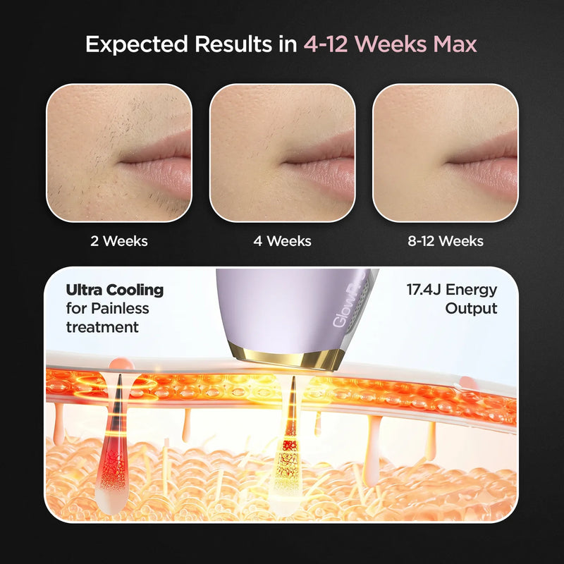 GlowPro IPL Ultra | 3-in-1 IPL Hair Removal Device