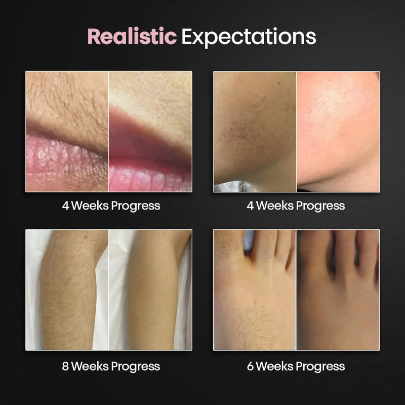 GlowPro IPL Ultra | 3-in-1 IPL Hair Removal Device